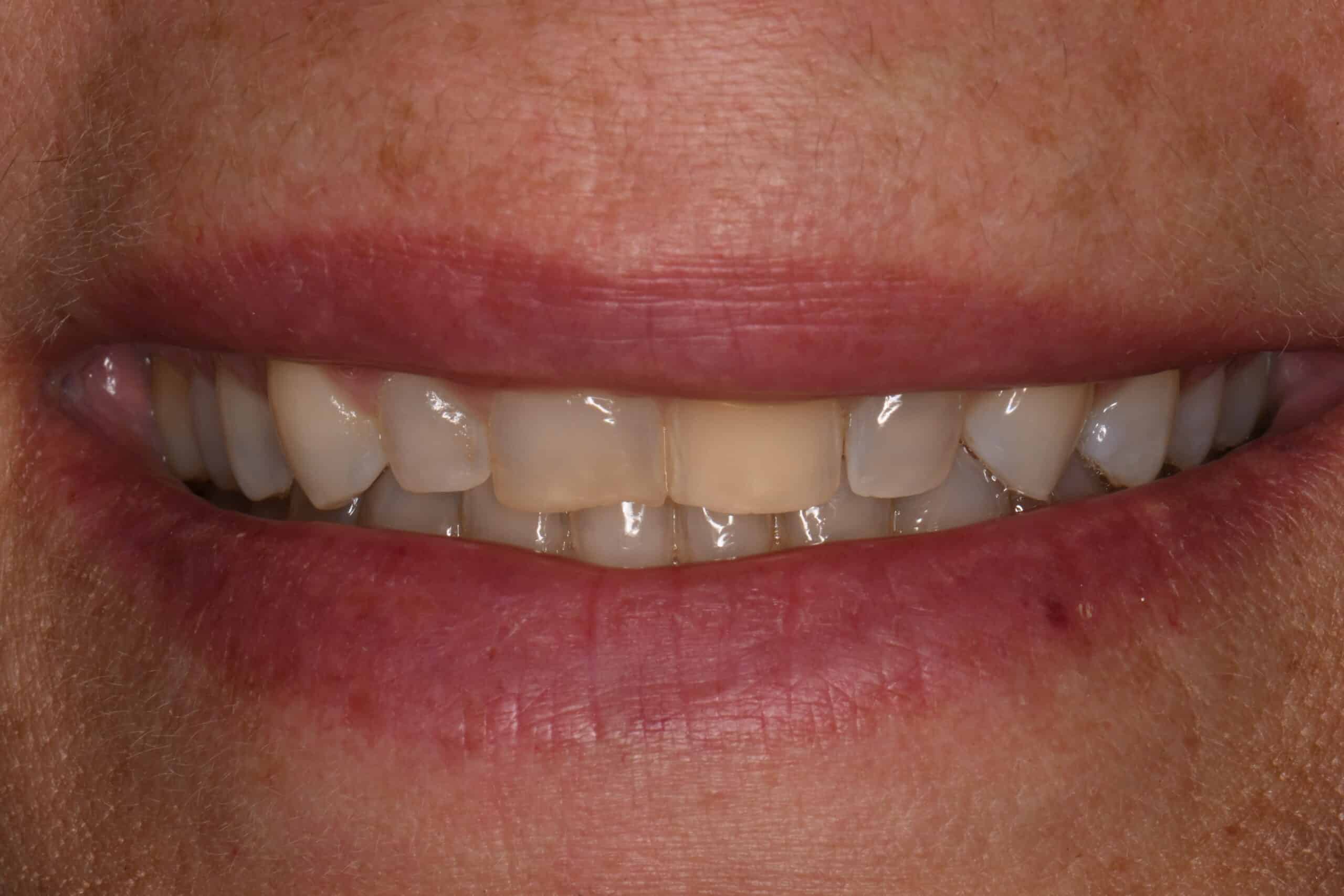 Smile before makeover